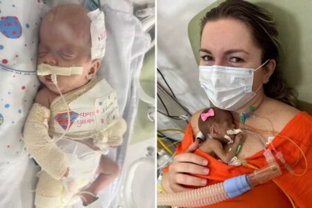 Bebê que nasceu com 580 gramas deixa hospital após passar por 12 cirurgias em Goiânia Yasmin passou oito meses internada