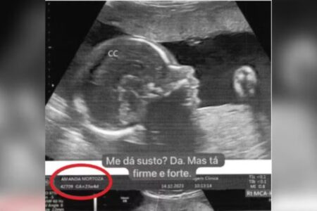 Amanda Partata enviou falso ultrassom ao ex dias antes do envenenamento advogada fingiu estar grávida para seis ex-namorados