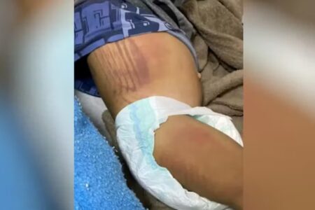Mãe e padrasto são condenados a prisão por torturar crianças em Cristalina Bebê de 1 anos era agredido nas partes íntimas com chineladas