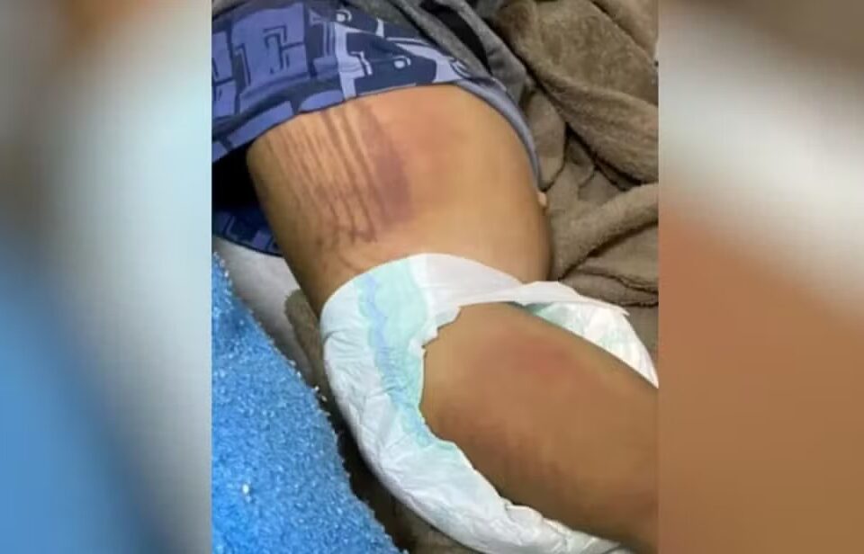 Mãe e padrasto são condenados a prisão por torturar crianças em Cristalina Bebê de 1 anos era agredido nas partes íntimas com chineladas