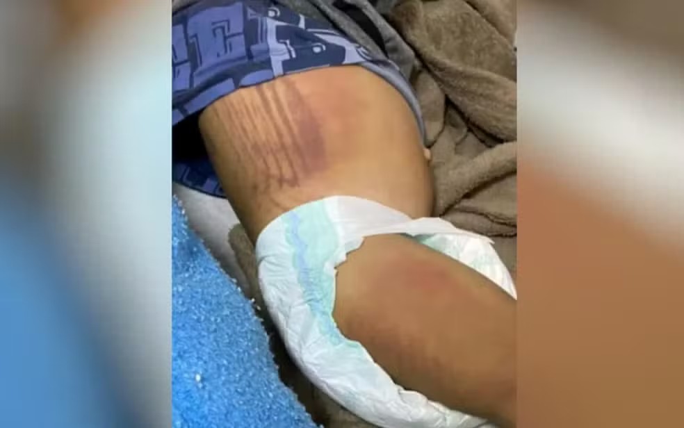Mãe e padrasto são condenados a prisão por torturar crianças em Cristalina Bebê de 1 anos era agredido nas partes íntimas com chineladas
