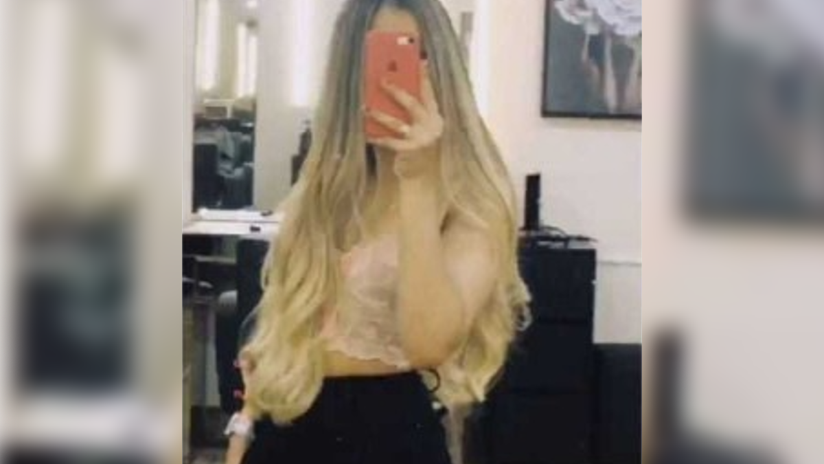 Heloísa Heliodoro, jovem de 17 anos que perdeu 80% do couro cabeludo em corrida de kart (Foto: reprodução)