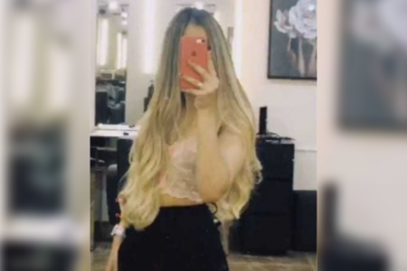 Heloísa Heliodoro, jovem de 17 anos que perdeu 80% do couro cabeludo em corrida de kart (Foto: reprodução)