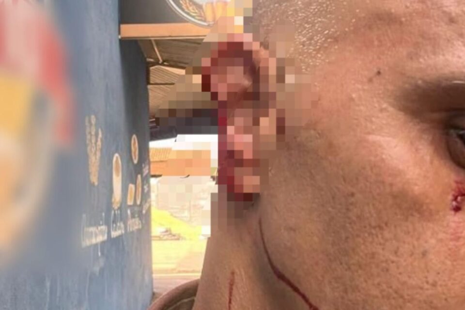 Policial ficou com a orelha ferida após mordida de homem em surto (Foto: PMGO)