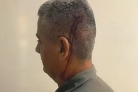 Segundo-tenente Cunha foi agredido ao intervir em confusão na cidade de Nazário (Foto enviada ao Mais Goiás)