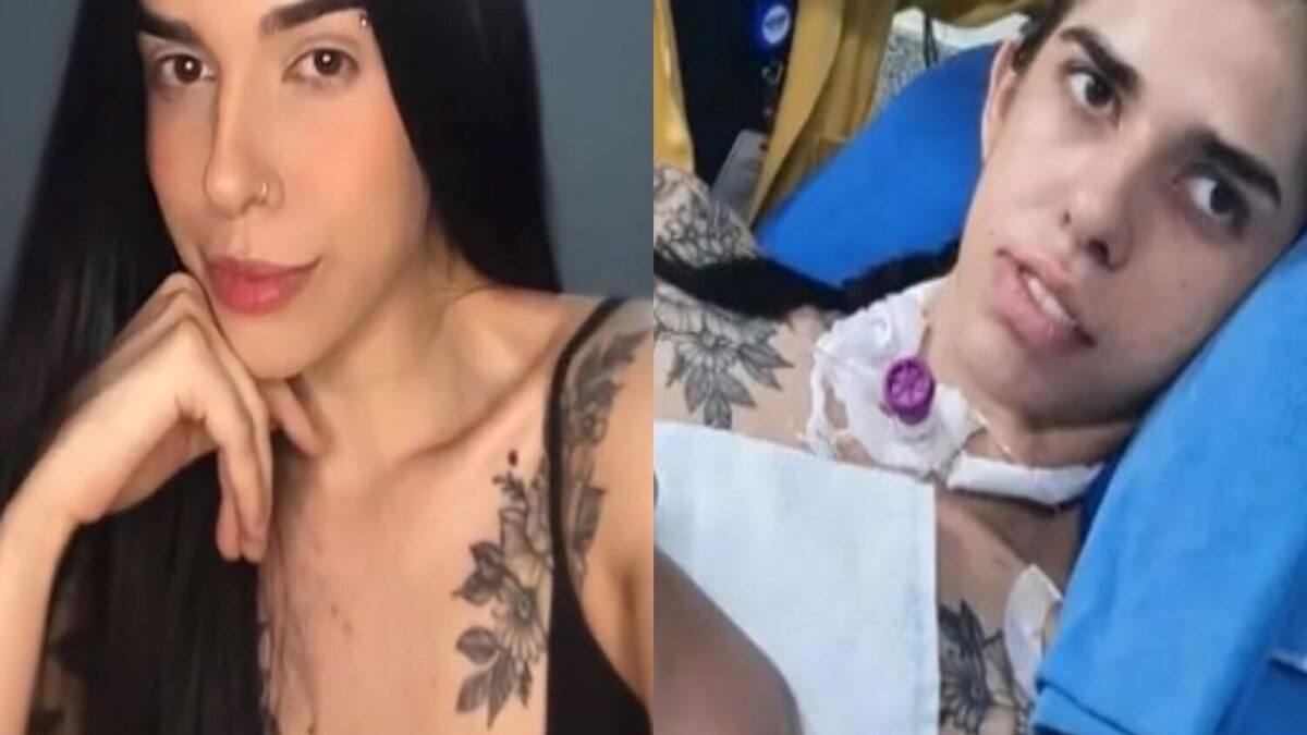 Imagem mostra o antes e depois da jovem que cheirou pimenta e teve reação alérgica.