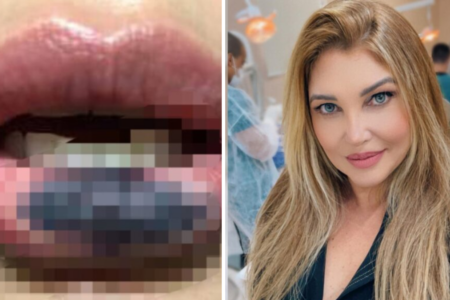 Odontóloga é indiciada após danos estéticos em Goiás (Foto: Reprodução)