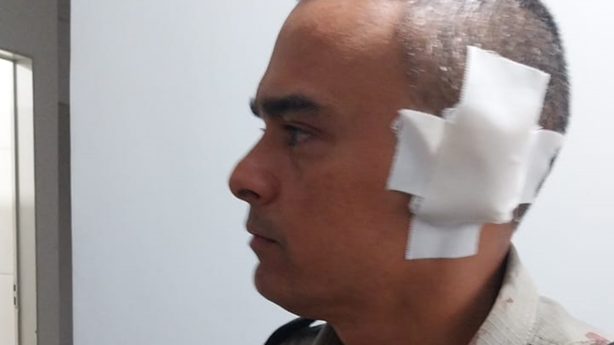 PM de Goiás leva tiro na orelha após confronto com suspeito de tráfico Suspeito do crime morreu no confronto