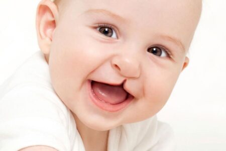 Projeto visa equiparar malformações congênitas a deficiências físicas em Goiás