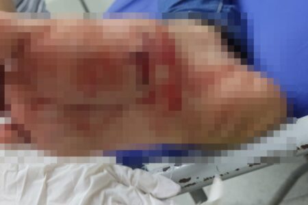 Imagem colorida mostra pé de mulher ferido a faca por companheiro que acabou preso (Foto: PM)
