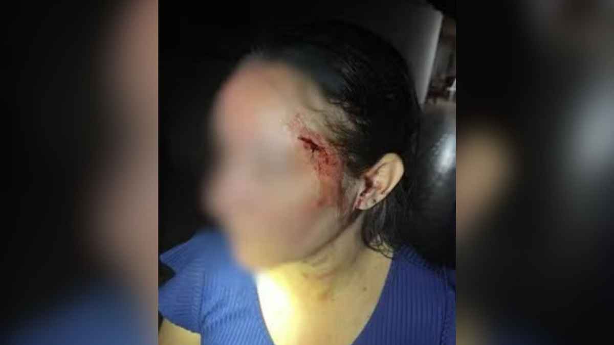 Policial é suspeito de agredir esposa por não encontrar chave, que estava no bolso dele