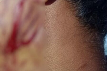 Tio esfaqueia sobrinho durante briga em Rio Verde Vítima foi levada para o Hospital Municipal Universitário (HMU)