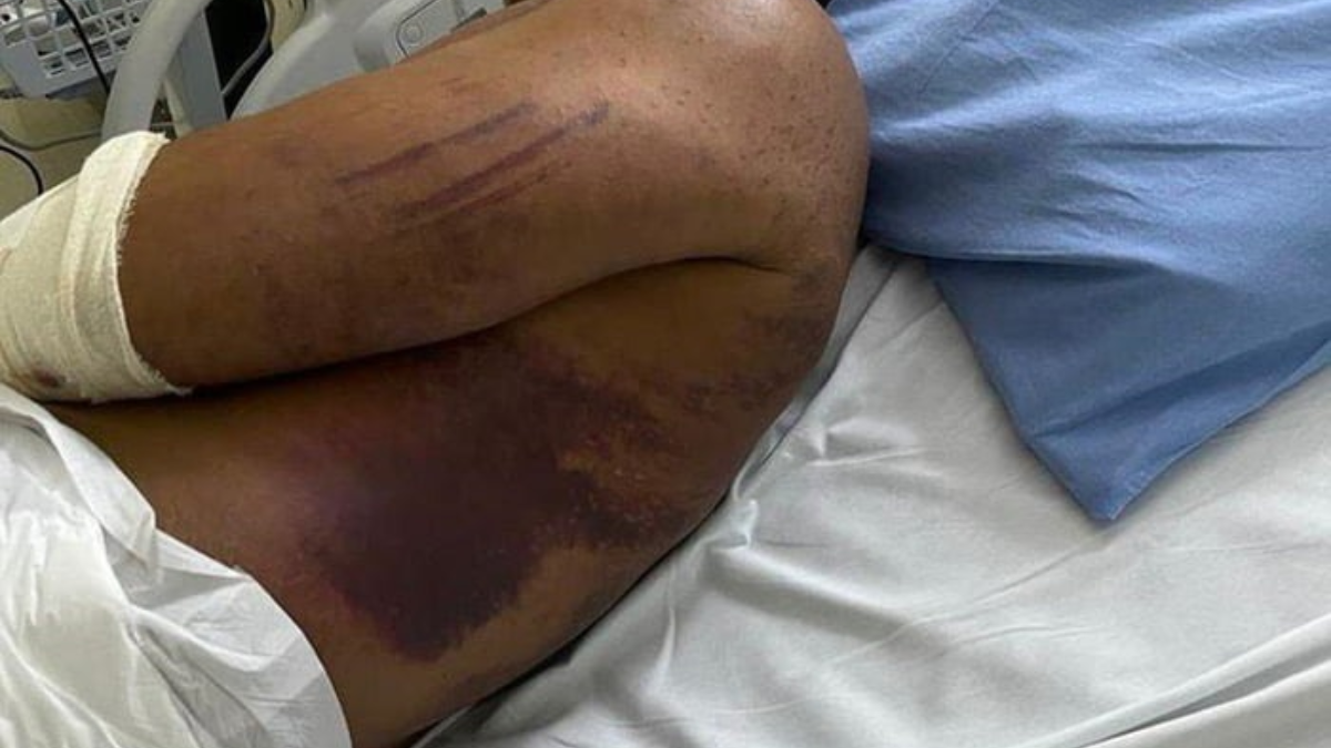 MP denuncia PMs por torturar e tentar matar major e dizer para família que ele estava internado com Covid