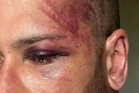 Fisiculturista suspeito de agredir e causa morte de esposa diz que sofreu agressão na prisão