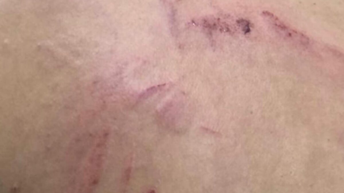 Companheira relata agressão por parte de companheiro (Foto: Reprodução - PM)