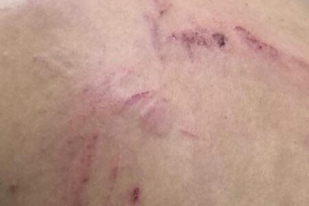 Companheira relata agressão por parte de companheiro (Foto: Reprodução - PM)