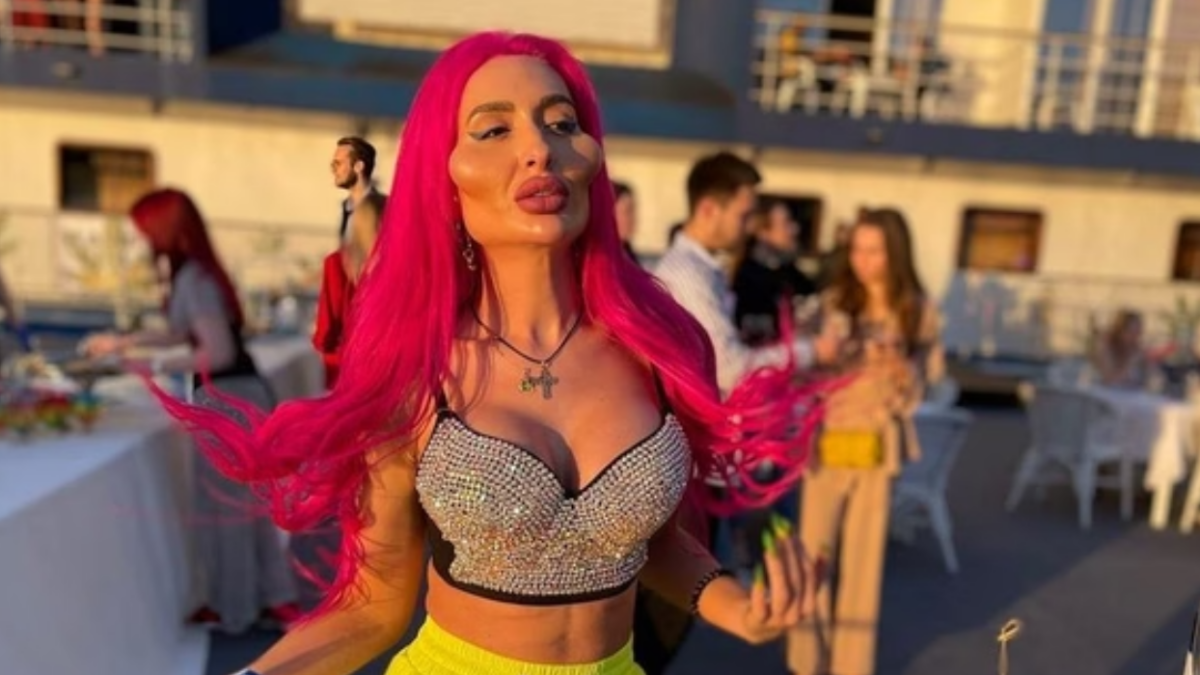 Anastasia Pokreshchuk tem as maiores bochechas do mundo (Foto reprodução Instagram)