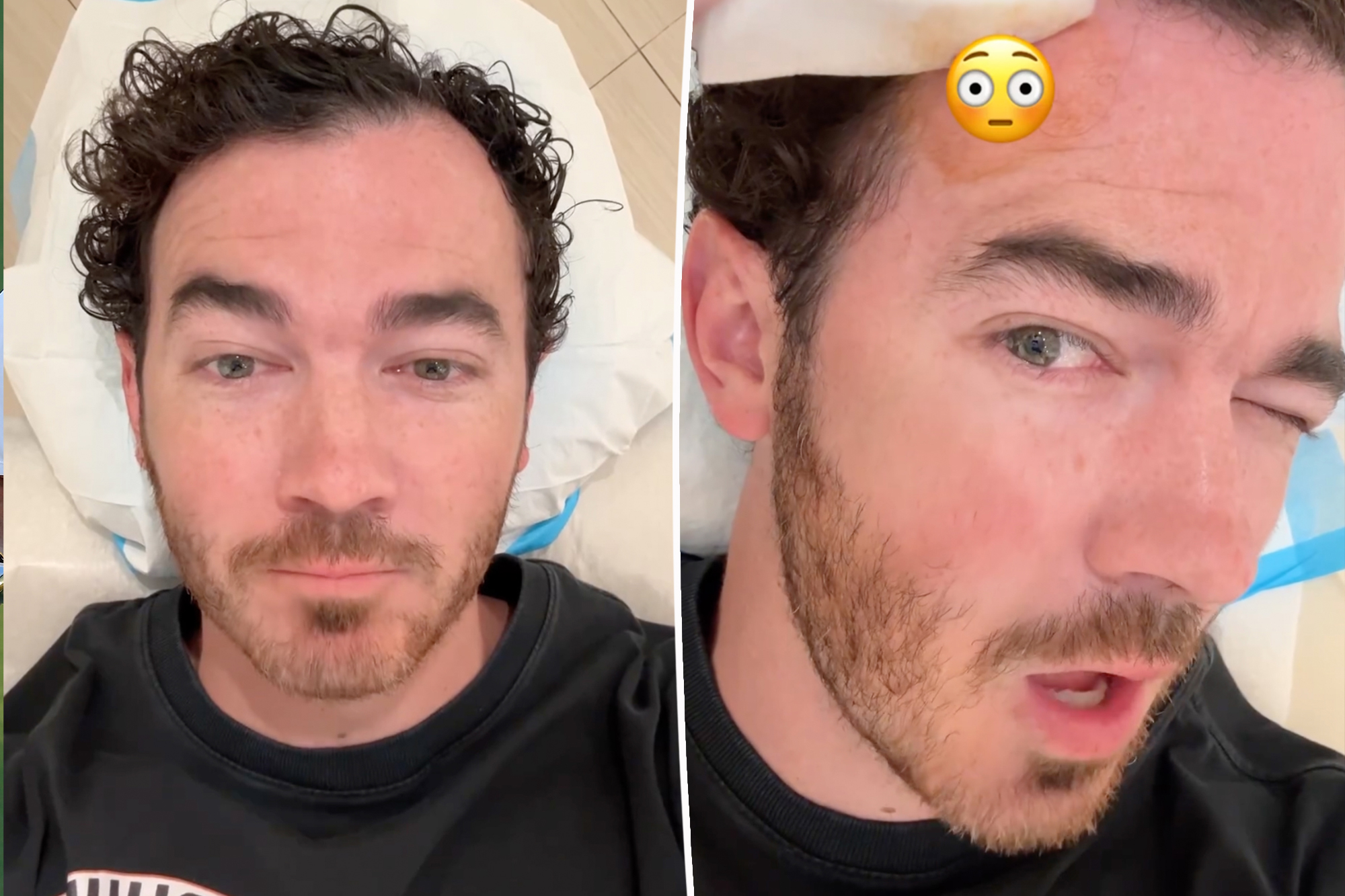 Kevin Jonas passa por cirurgia para remover uma célula cancerígena