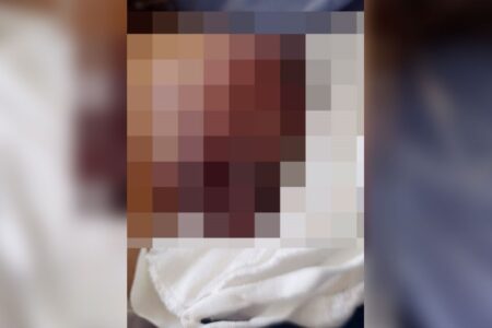 Goiânia: defesa de idosa que perdeu braço em acidente de ônibus diz que empresa só falou em pagar cuidadora: "Ínfimo"