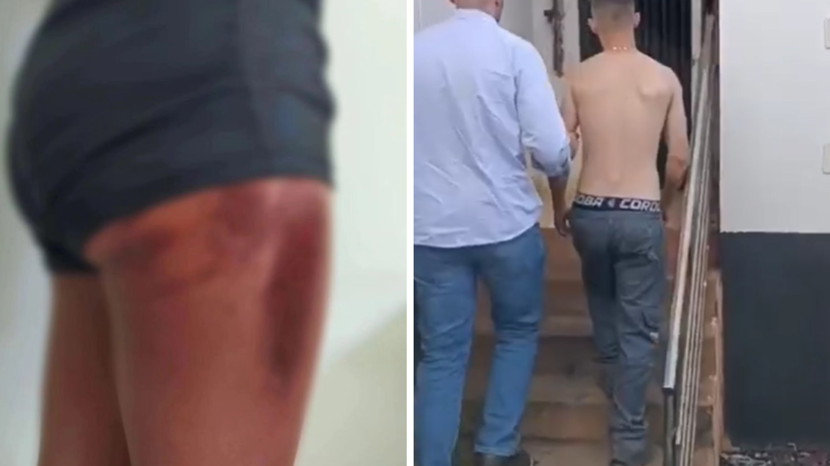 À esquerda, mulher ferida após pular de carro em movimento. À direita, o homem preso