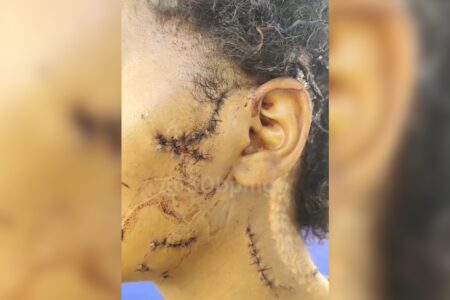 Menina com rosto rasgado em Aparecida (Foto: Reprodução)