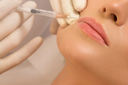 Entenda o que é PMMA e os riscos do uso em procedimentos estéticos CFM alerta para risco de intervenções consideradas invasivas