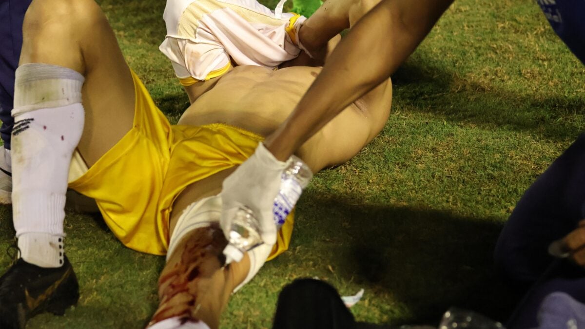 Goleiro Ramon com sangue na perna após tiro