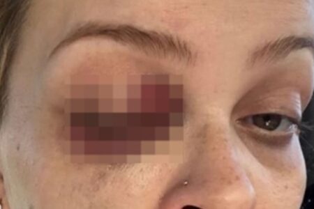 Filha de ex-deputado que denunciou marido por agressões diz que desenvolveu doença autoimune por causa do psicológico afetado