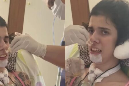 Goiana que teve reação alérgica após cheirar pimenta consegue sentir sabor de carne, Thais Medeiros sentiu sabor de caldo de carne