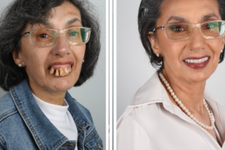 Mulher passa por transformação nos dentes e surpreende a web