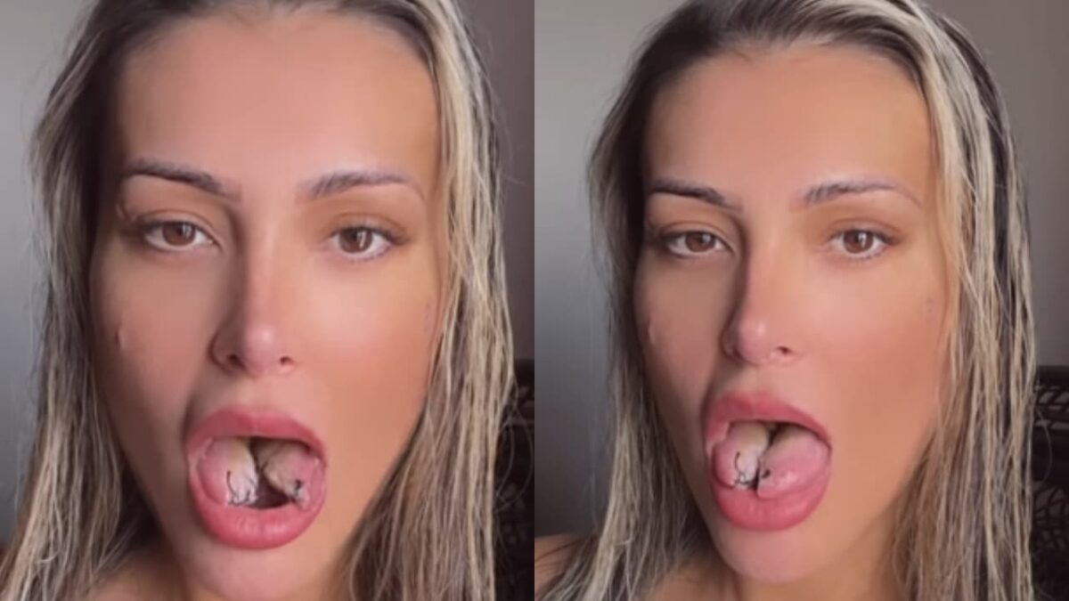 Andressa Urach realiza cirurgia de bifurcação de língua e movimenta redes sociais