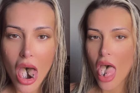 Andressa Urach realiza cirurgia de bifurcação de língua e movimenta redes sociais