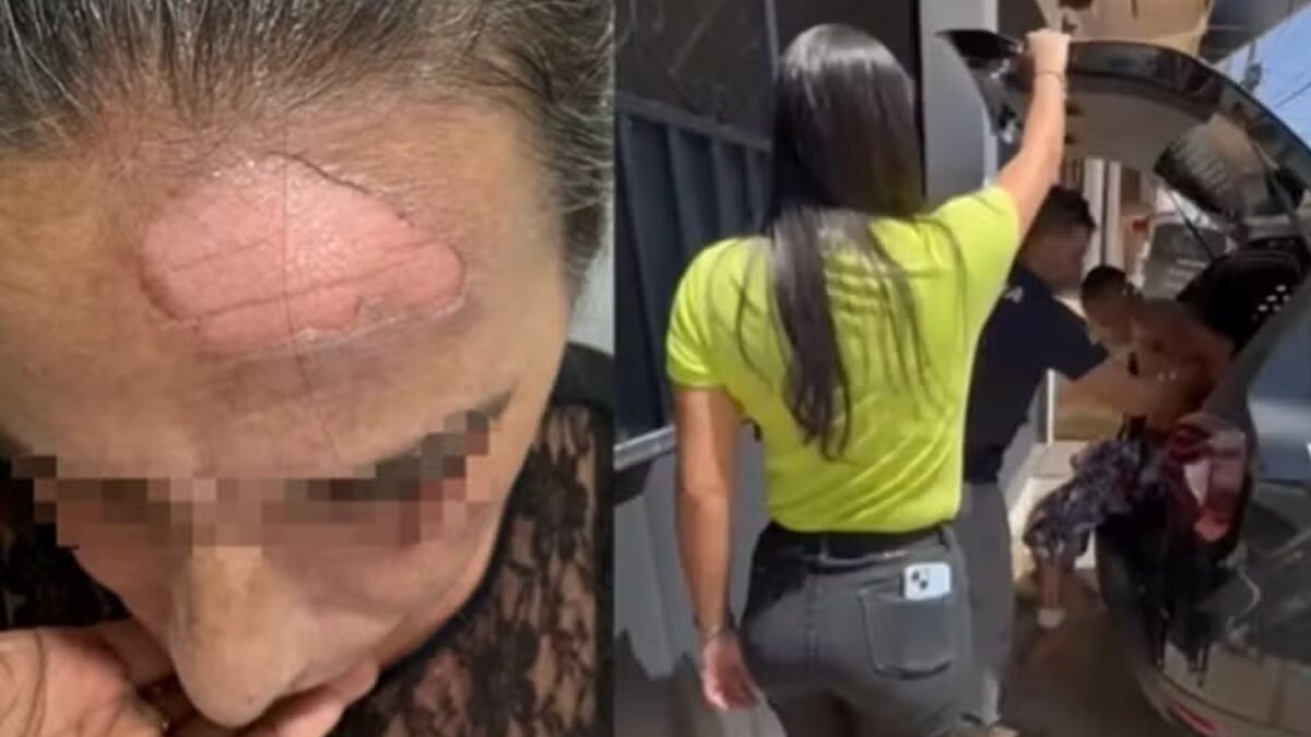 Filho é suspeito de jogar café quente no rosto da mãe por briga de R$ 10, diz polícia