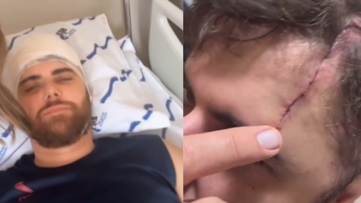 Zé Neto mostra ferimento na cabeça após acidente