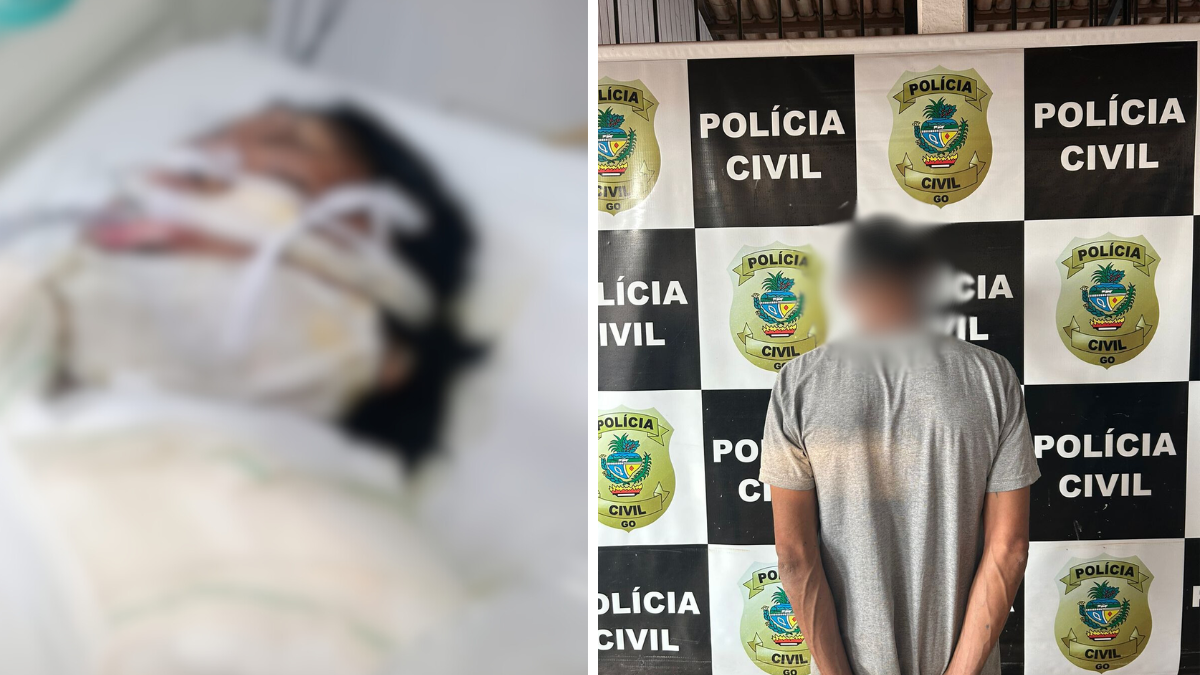 Mulher morre após ter corpo queimado pelo companheiro