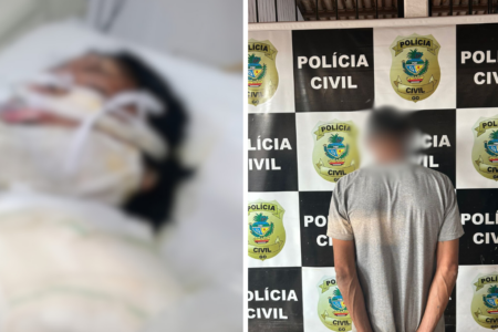 Mulher morre após ter corpo queimado pelo companheiro