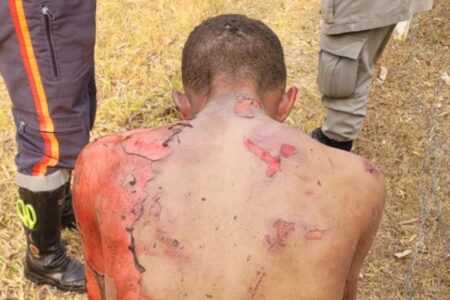 Morro homem que teve corpo queimado ao tentar furtar sandália em supermercado de Aparecida