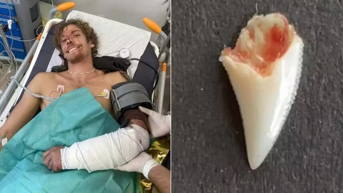 Jovem faz brincos com dentes de tubarão que o atacou Angus Kockott esfaqueou o predador e ficou com os dentes do animal cravados no braço