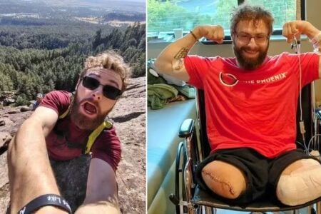 Tornozeleira eletrônica prende em triturador e homem perde as pernas no primeiro dia de trabalho Triturador de madeira arrastou os membros