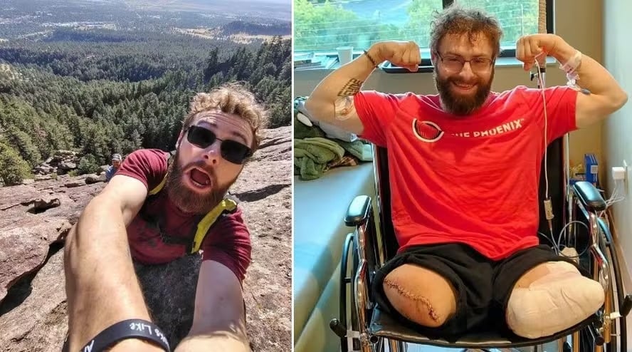 Tornozeleira eletrônica prende em triturador e homem perde as pernas no primeiro dia de trabalho Triturador de madeira arrastou os membros