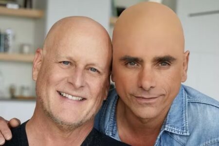 Ator é criticado por usar 'falsa careca' para apoiar o colega que faz quimioterapia Ator postou foto com o amigo