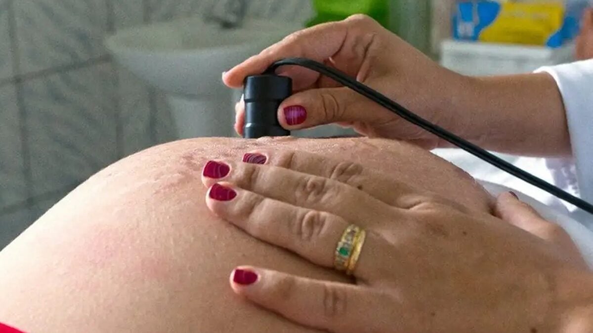 Especialistas alertam para a importância do pré-natal e da presença do pediatra na sala de parto