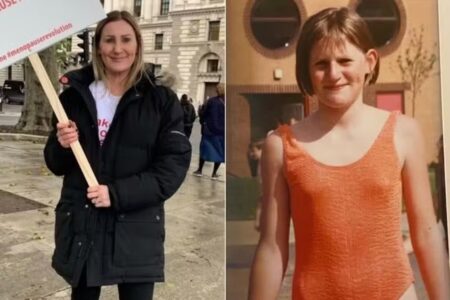 Britânica com caso raro entrou na menopausa aos 14 anos Hayley Brookes disse que sofria de suores noturnos intensos, ondas de calor e insônia