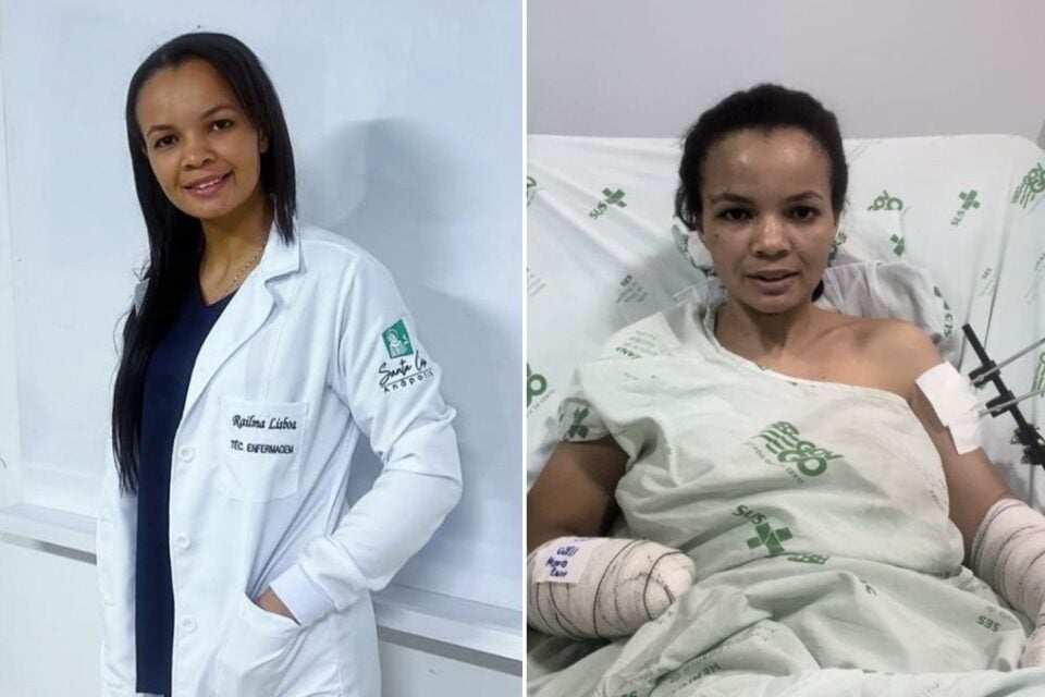 Railma Lisboa sobreviveu a uma tentativa de feminicídio, em Anápolis, Goiás
