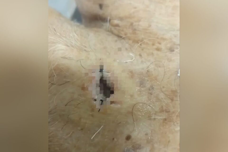João Antônio Firmino, de 82 anos, ficou internado 25 dias na unidade hospitalar em Santa Helena de Goiás