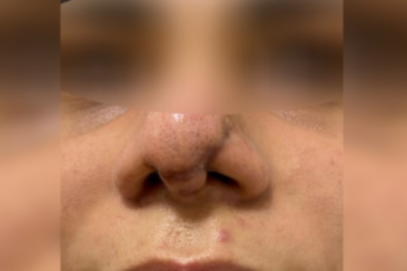 Paciente com rosto deformado após passar por clínica de influenciadora (Foto: Reprodução)