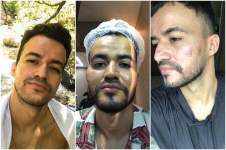 "Açougue", diz ex-cliente de clínica de Karine Gouveia