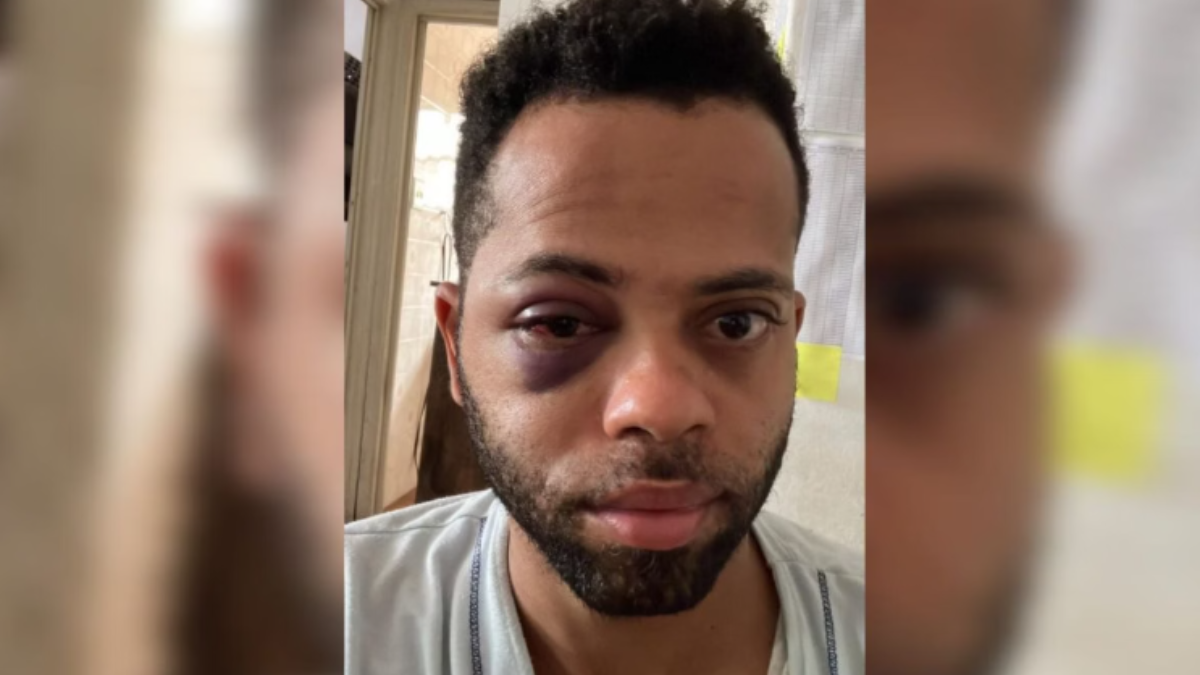 Homem acusa policiais de agressão e racismo durante abordagem, em SP
