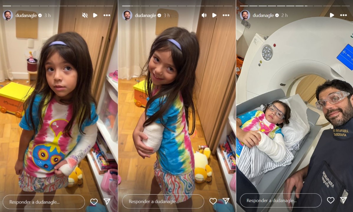 Zoe, filha de Duda Nagle e Sabrina Sato, precisou imobilizar o braço - Reprodução/Instagram