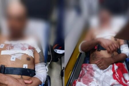 Torcedores são atacados e hospitalizados após confronto (Foto: Reprodução redes sociais)